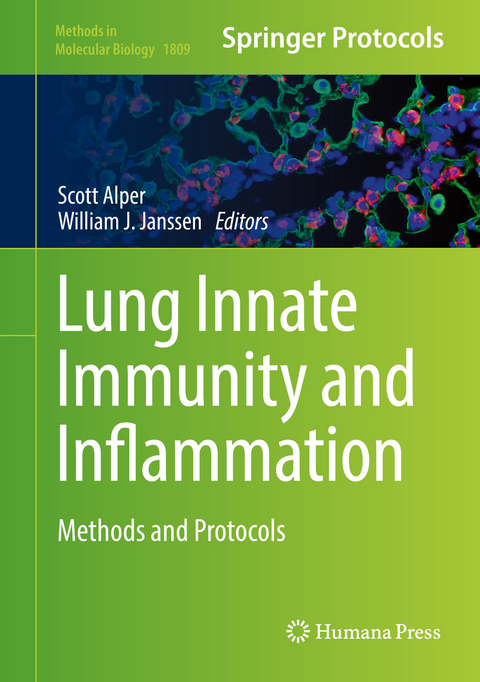 Lung Innate Immunity and Inflammation - 