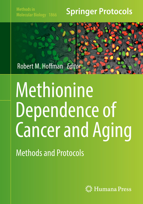 Methionine Dependence of Cancer and Aging - 