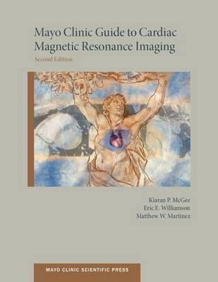 Mayo Clinic Guide to Cardiac Magnetic Resonance Imaging -  Eric Williamson MD,  Matthew Martinez MD,  Kiaran McGee PhD