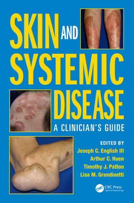 Skin and Systemic Disease -  Joseph C. English III,  Lisa M. Grandinetti,  Arthur C. Huen,  Timothy J. Patton