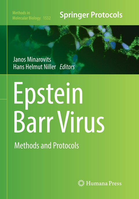 Epstein Barr Virus - 