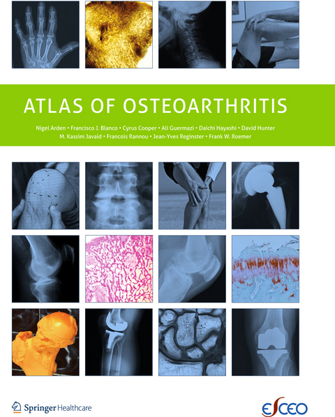 Atlas of Osteoarthritis -  Nigel Arden,  Frank Roemer,  Francisco Blanco,  C. Cooper,  Ali Guermazi,  Daichi Hayashi,  David Hunter,  M. Kassim Javaid,  Francois Rannou,  Jean-Yves Reginster