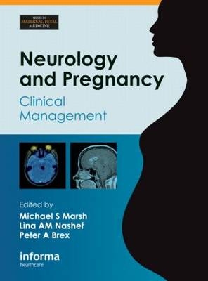 Neurology and Pregnancy - 