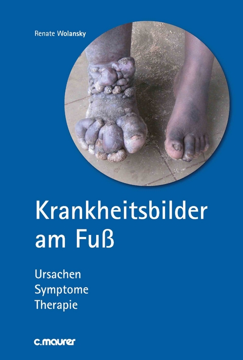 Krankheitsbilder am Fuß - Renate Wolansky