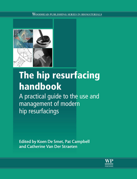 Hip Resurfacing Handbook - 