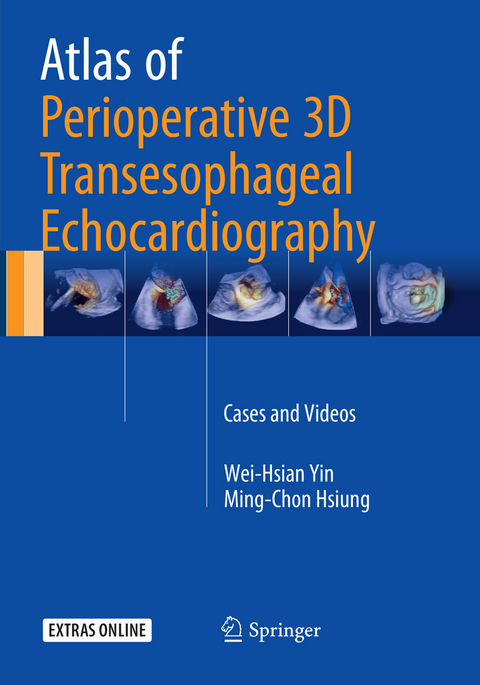 Atlas of Perioperative 3D Transesophageal Echocardiography - Wei-Hsian Yin, Ming-Chon Hsiung