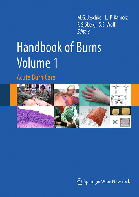 Handbook of Burns Volume 1 - 