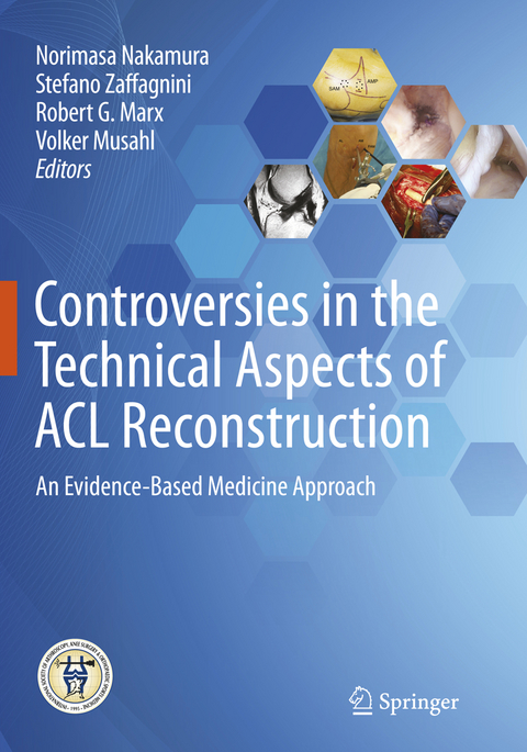 Controversies in the Technical Aspects of ACL Reconstruction - 