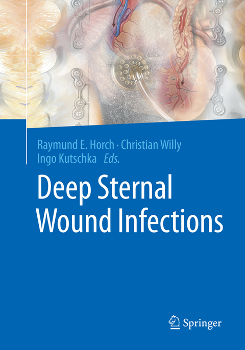 Deep Sternal Wound Infections - 