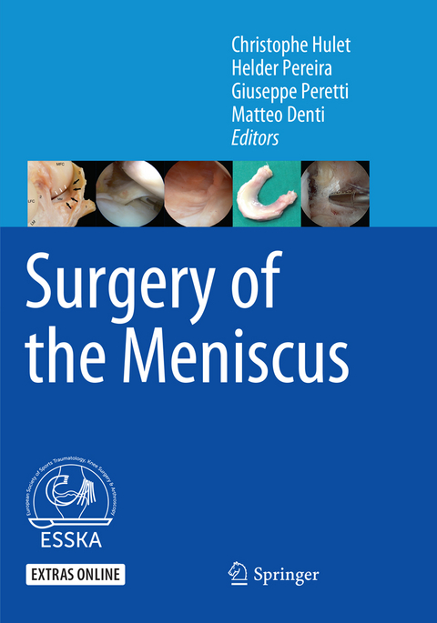 Surgery of the Meniscus - 