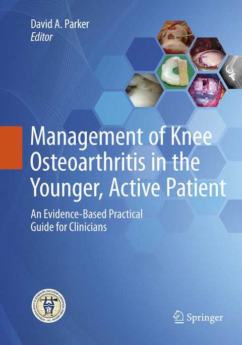 Management of Knee Osteoarthritis in the Younger, Active Patient - 