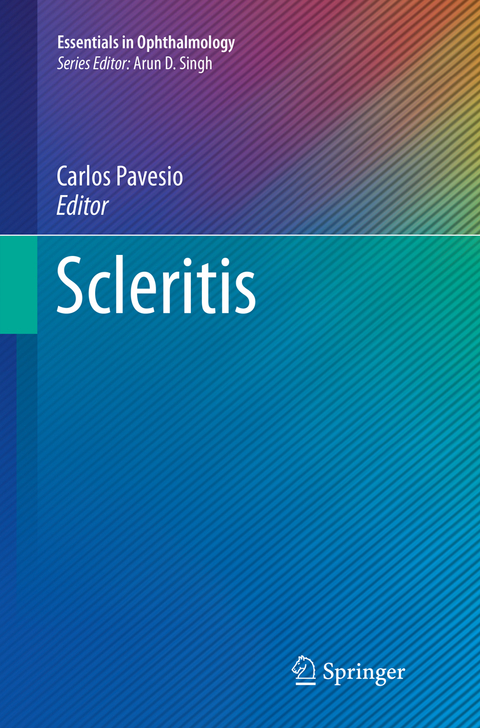 Scleritis - 