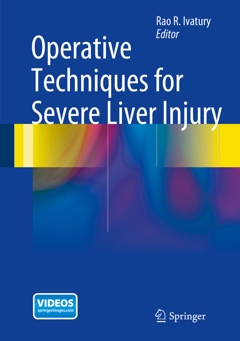 Operative Techniques for Severe Liver Injury - 