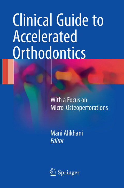 Clinical Guide to Accelerated Orthodontics - 