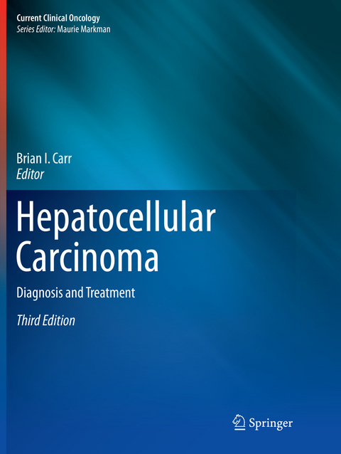 Hepatocellular Carcinoma - 