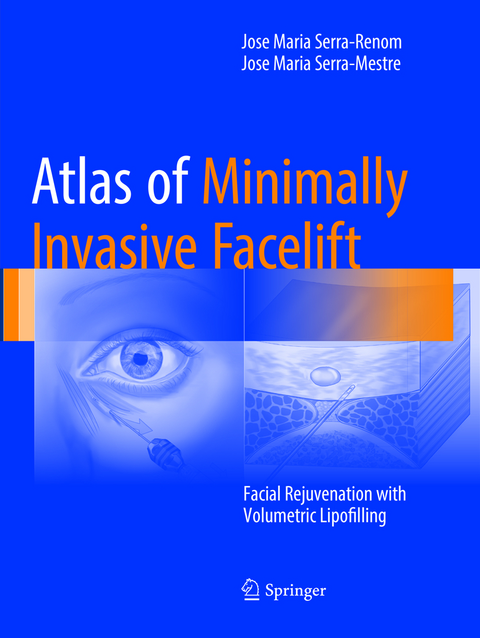 Atlas of Minimally Invasive Facelift - Jose Maria Serra-Renom, Jose Maria Serra-Mestre