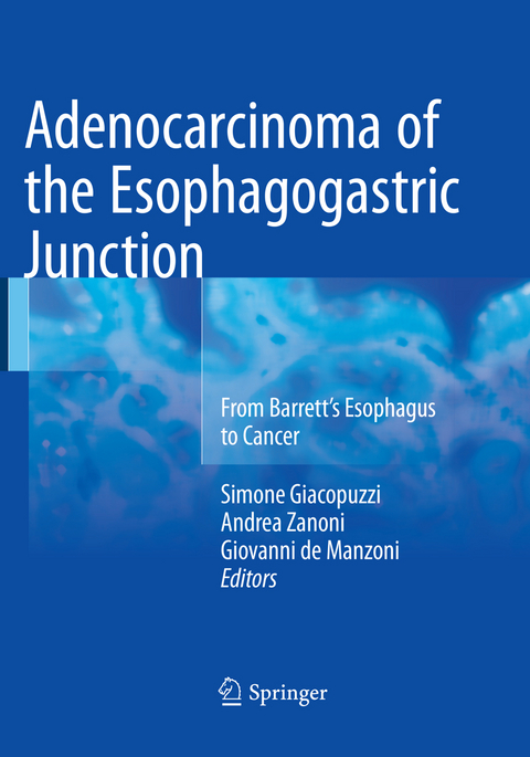 Adenocarcinoma of the Esophagogastric Junction - 