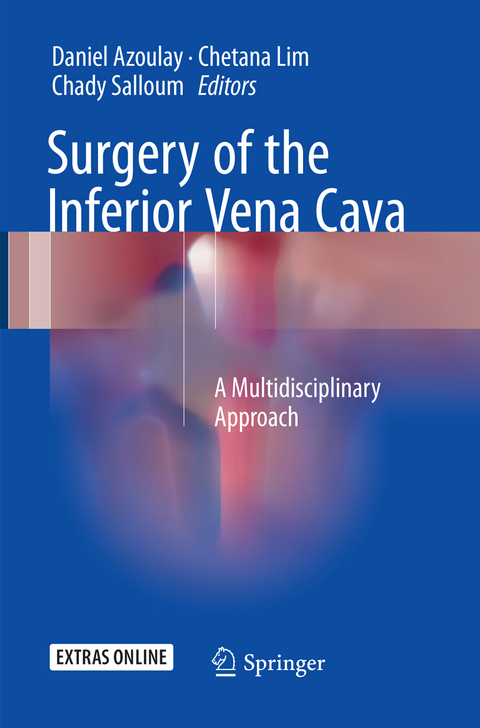 Surgery of the Inferior Vena Cava - 