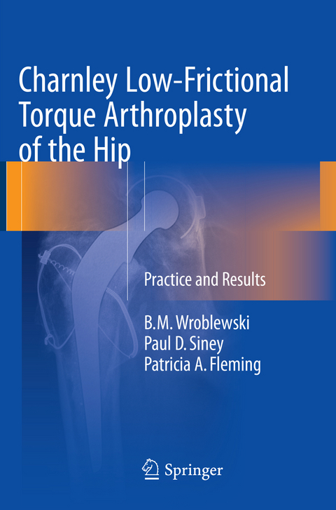 Charnley Low-Frictional Torque Arthroplasty of the Hip - B.M. Wroblewski, Paul D. Siney, Patricia A. Fleming