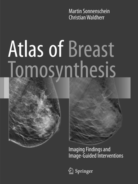 Atlas of Breast Tomosynthesis - Martin Sonnenschein, Christian Waldherr