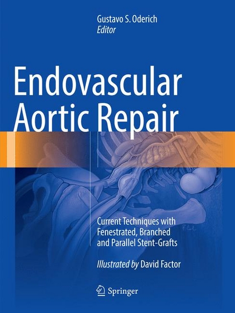 Endovascular Aortic Repair - 