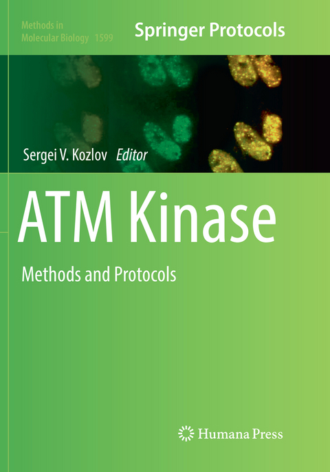 ATM Kinase - 