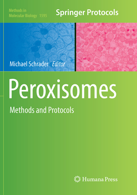 Peroxisomes - 