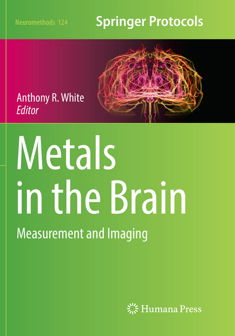 Metals in the Brain - 