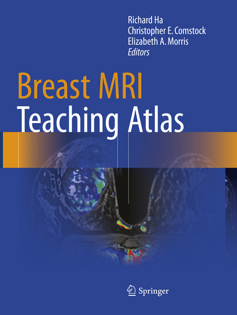 Breast MRI Teaching Atlas - 