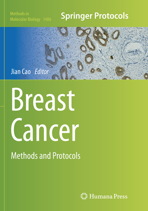 Breast Cancer - 