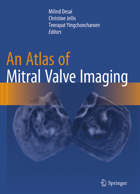 An Atlas of Mitral Valve Imaging - 