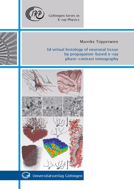 3d virtual histology of neuronal tissue by propagation-based x-ray phase-contrast tomography - Mareike Töpperwien