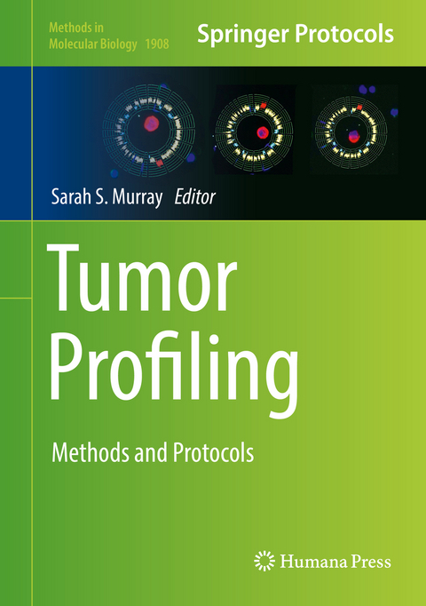 Tumor Profiling - 