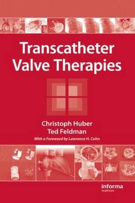 Transcatheter Valve Therapies -  Ted Feldman,  Christoph Huber