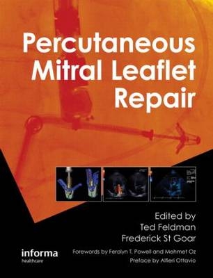 Percutaneous Mitral Leaflet Repair - 