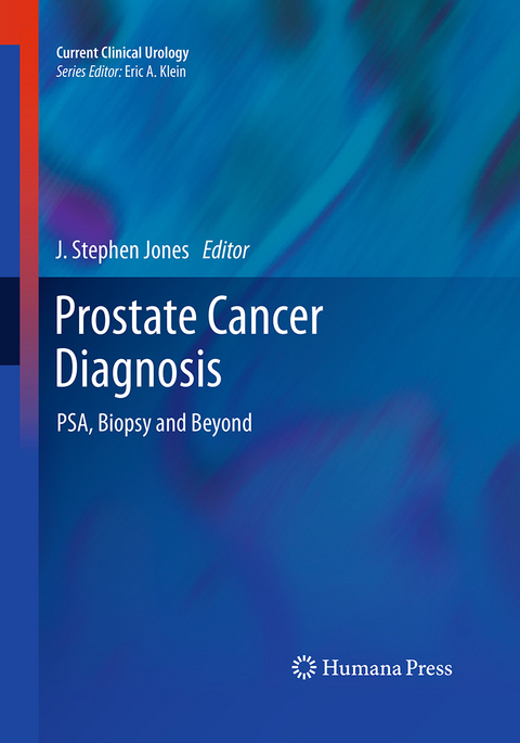 Prostate Cancer Diagnosis - 