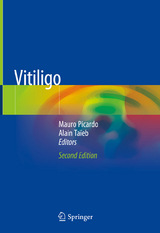 Vitiligo - Picardo, Mauro; Taïeb, Alain