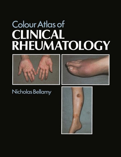 Colour Atlas of Clinical Rheumatology - N. Bellamy