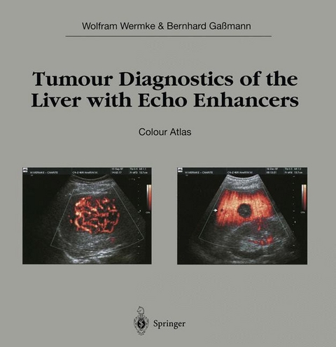 Tumour Diagnostics of the Liver with Echo Enhancers - Wolfram Wermke, Bernhard Gaßmann