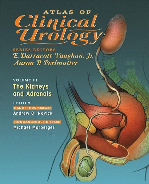 Atlas of Clinical Urology - 