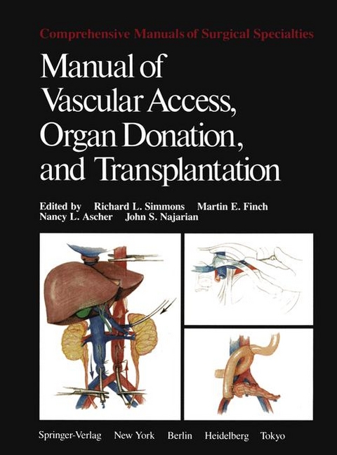 Manual of Vascular Access, Organ Donation, and Transplantation - 