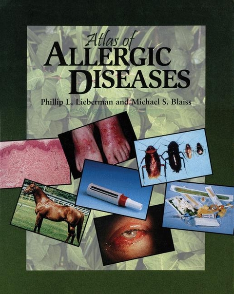 Atlas of Allergic Diseases - 