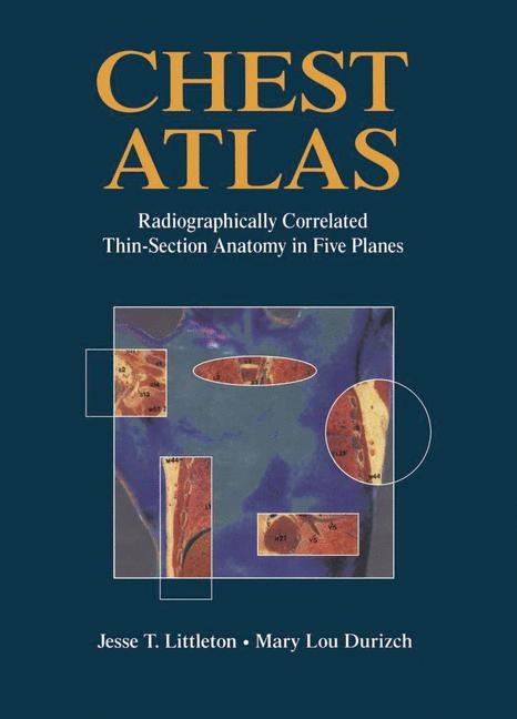 Chest Atlas - Mary L. Durizch, Jesse T. Littleton