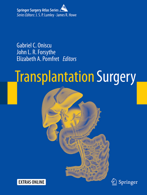 Transplantation Surgery - 