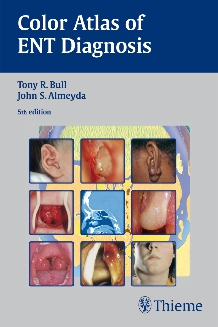 Bull's Color Atlas of ENT Diagnosis - John S. Almeyda, Benjamin Hartley