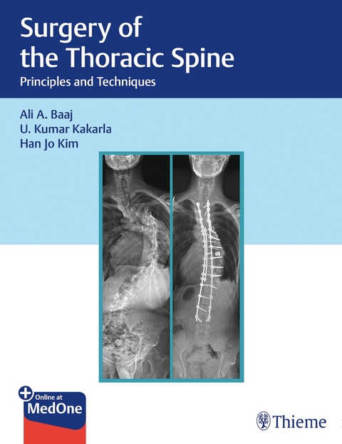 Surgery of the Thoracic Spine - Ali Baaj, U. Kumar Kakarla, Han Jo Kim