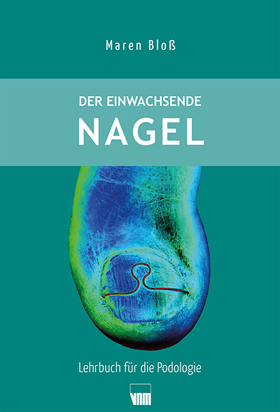 Der einwachsende Nagel - Maren Bloß