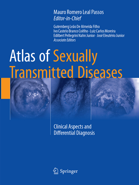 Atlas of Sexually Transmitted Diseases - 