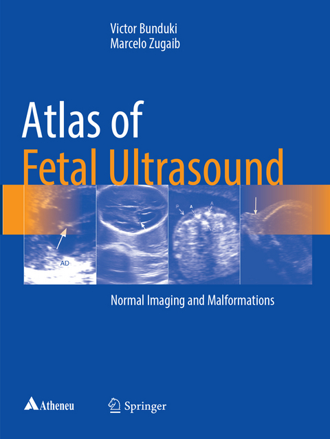 Atlas of Fetal Ultrasound - Victor Bunduki, Marcelo Zugaib