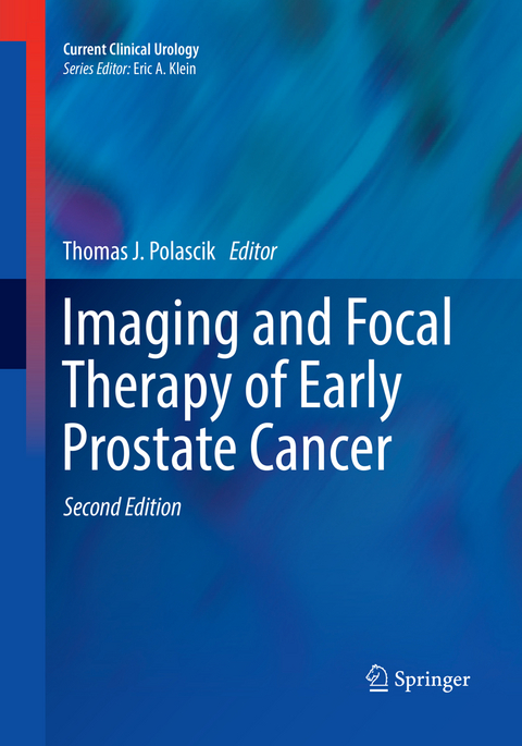 Imaging and Focal Therapy of Early Prostate Cancer - 